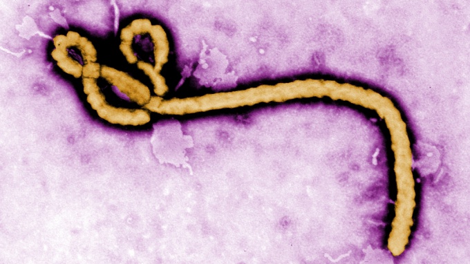 Febre Ebola: sintomas, tratamento